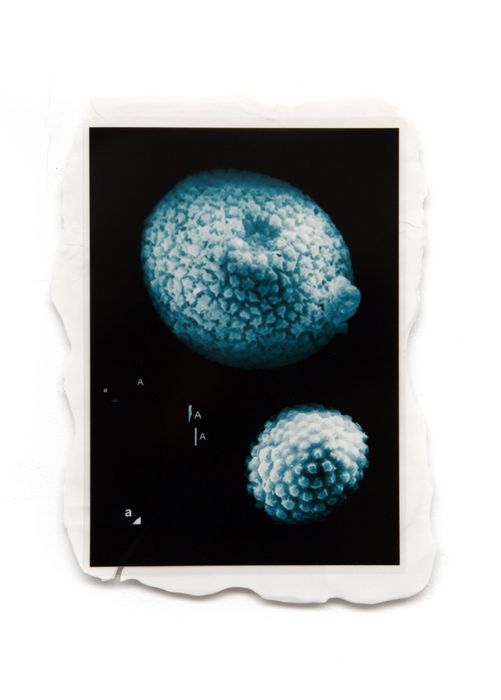Pl.11_ Deux spicules et cinq a